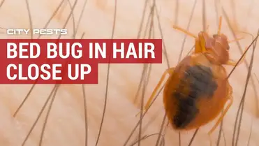Bed Bugs In Hair Symptoms Pictures And Treatment For Bugs In Hair