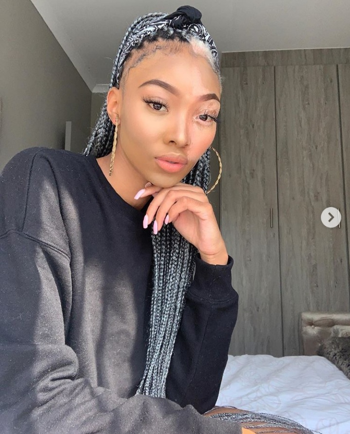 Top 5 Mzansi Celebrities Living with Vitiligo in south Africa.