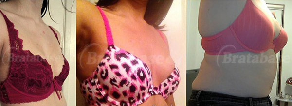 34b cup breast Clearance